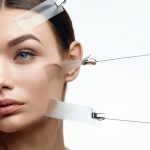 Profound RF micro-needling Newport News, VA